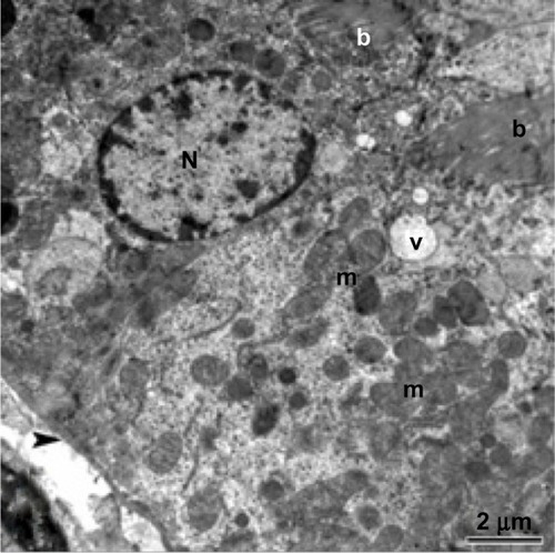 Figure 5 Transmission electron micrograph of kidney tubule tissue from the control group showing normal ultrastructure of the tubular epithelial cell layer in the basement membrane (arrow head). Note the nucleus, mitochondria, brush border, and membranous vesicles. Scale bar 2 μm.Abbreviations: b, brush border; m, mitochondria; N, nucleus; v, membranous vesicles.