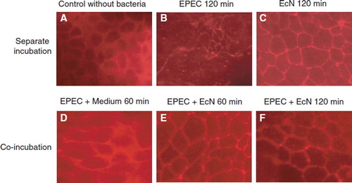 Figure 15. Effects of the non-pathogenic E. coli strain Nissle 1917 (EcN) and the enteropathogenic E. coli (EPEC) strain E2348/69 on the distribution of the tight junction protein zonula occludens-2 (ZO-2) in T84 epithelial cells (Citation115). T84 monolayers were incubated with bacteria for different periods of time and stained for ZO-2 using a fluorescent anti-ZO-2 antibody. (A) Control, T84 epithelial cells without bacteria. (B) T84 cells incubated with EPEC for 120 min. (C) T84 cells incubated with EcN for 120 min. (D) T84 cells incubated with EPEC for 60 min, then washed and further incubated with regular medium for another 60 min. (E) T84 cells incubated with EPEC for 60 min, then washed and further incubated with EcN for another 60 min. (F) T84 cells co-incubated with EcN plus EPEC for 120 min. Bacteria were added in a 1:1 ratio. The EcN strain had no negative influence on the distribution of the tight junction protein ZO-2, but abolished the negative impact of EPEC on ZO-2 distribution.