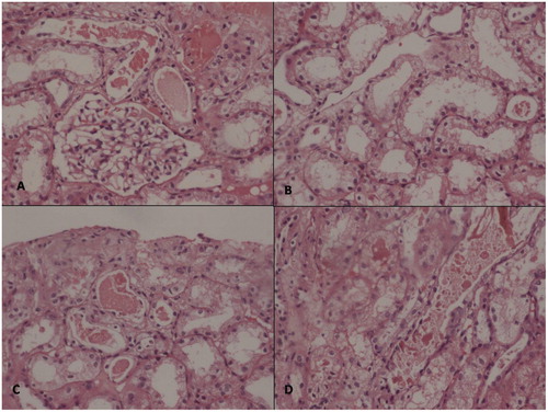 Figure 2. (A) Glomerulus showing normal size and cellularity with normal thickness of the basement membrane. (B) The tubular epithelial cells showing vacuolation of the lining epithelial cells (C & D) Intratubular RBC casts.