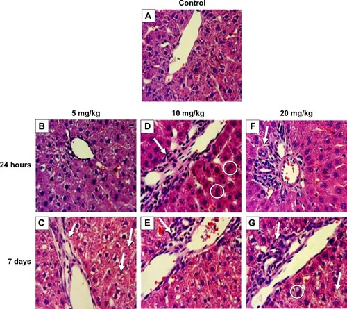 Figure 6 Effect of ZnO nanoparticles on liver histology of male Wistar Han rats.Notes: (A) Control (intravenously injected with sterile saline). (B) At 24 hours, hepatocyte swelling was evident with an intravenous dose of 5 mg/kg of ZnO engineered nanoparticles (ENPs). (C) After 7 days, granulation and necrotic regions accompanied by neutrophil infiltration were observed; the arrow on the left indicates neutrophil infiltration; the arrows on the right indicate granulation and necrotic regions. (D) At 24 hours, 10 mg/kg ZnO ENPs caused an influx of neutrophils (arrow) and binucleated hepatocytes (circled). (E) At 7 days, inflammation and liver necrosis were evident (arrow). (F) At 24 hours, 20 mg/kg ZnO ENPs induced inflammatory cell infiltration (arrow). (G) At 7 days, inflammatory cell infiltration remained (upper arrow), along with binucleated cells (circled) and some necrosis (lower arrow).