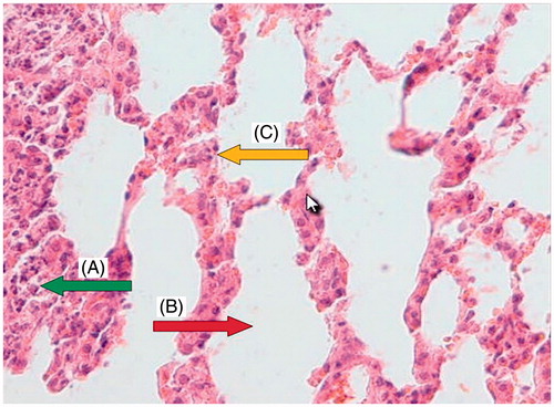 Figure 4. Group pretreated with 400 mg/kg Origanum for 7 d before CP administration: a section of mouse lung tissue showing remnants of neutrophilic infiltration and cell debris (A, green arrow), normal alveolar space (B, red arrow), and alveolar septa showing focally hyperplastic pneumocytes and RBC extravasation (C, yellow arrow). (Hematoxylin and eosin-stained paraffin sections; H&E × 400.)