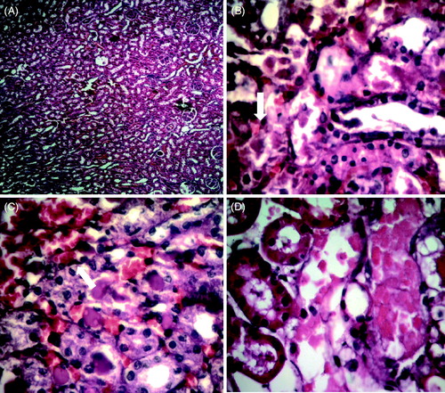 Figure 1. Photomicrographs of histopathological alterations in renal tissues in response to cisplatin and PSO + cisplatin (H&E staining). Rat kidney sections from the control group showing normal histology (A, X100). Cisplatin-treated rat kidney showing tubular cell necrosis (B), hyaline casts and vascular congestion (C, X400). The arrows indicate tubular necrosis and hyaline casts. PSO + cisplatin-treated rats showed dramatic improvement in the histologic appearance. Minimal tubular necrosis was observed in group III and IV (D, X400).