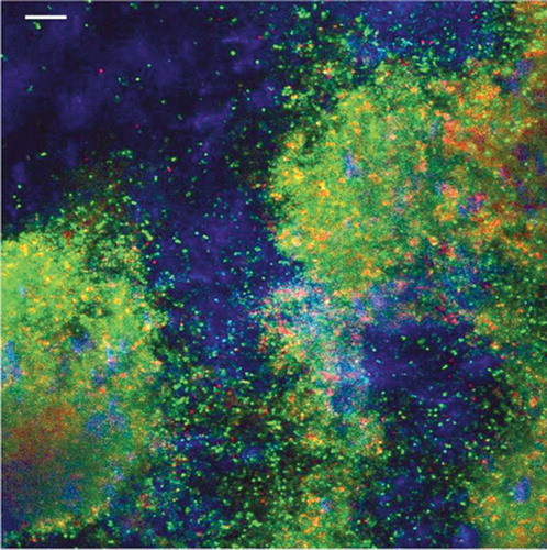 Figure 1. Confocal laser scanning microscope overlay image of a 4-day-old Staphylococcus aureus biofilm on polyethylene. The sample was stained with a live/dead stain (green/red) and with Calcofluor white (blue) for slime staining. The bar represents 10 µm.