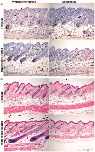 Figure 3. Representative micrographic pictures of skin samples after anti-BrdU staining (A) or H&E staining (B). Scale bar = 2 mm. For a full-color version of the figure, the reader is referred to the online version of the article.