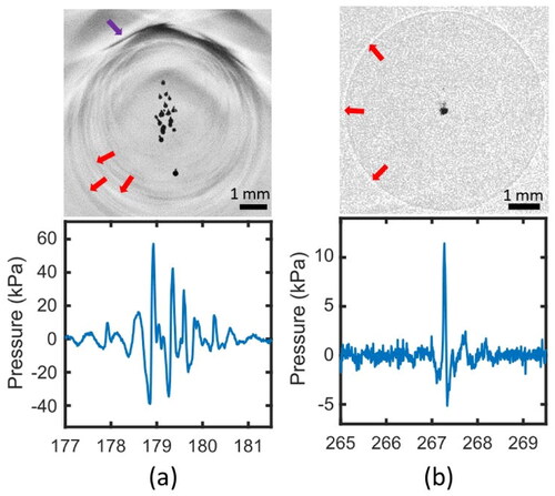 Figure 6. Shockwaves from inertial cavitation. (a) The cavitation cloud nucleation emits a cluster of overlapping shockwaves. (b) The cavitation cloud collapse often emits a single shockwave. Top: shadowgraph images, bottom: hydrophone recordings at 12 cm from the shockwave origin. Red arrows denote shockwaves. The purple arrow denotes the histotripsy wavefront, propagating upwards in these images (this figure is adapted from Yeats et al. [Citation162]).