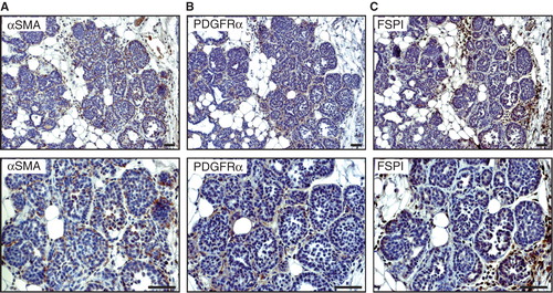 Figure 1. Expression of fibroblast markers in 6-week-old MMTV-PyMT mice. Representative immunostaining of hyperplastic lesions of a 6-week-old MMTV-PyMT mouse showing the expression pattern of ASMA (A), PDGFRα (B), and FSP1 (C). Scale bar is indicated in the figure and represents 50 µm.