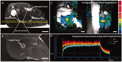 Figure 2. Treatment planning and temperature measurements during a 40 min mild hyperthermia treatment. Treatment planning was performed based on T2-weighted MR images indicating the tumor location (A,B). (C) Temperature maps across and along the ultrasound beam show the heating pattern in the middle of the treatment. The treated ROI is indicated by the white circle and the black contour indicates the 42 °C isotherm. The mean temperature, T10, and T90 within the ROI are shown in D confirming stable temperature control at 42 °C during the treatment. The beginning and end of the treatment area marked with the green vertical lines. Scale bar = 2 cm.
