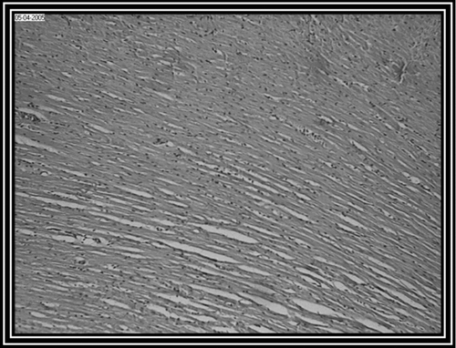 Figure 3.  Ethanol Embelia ribes extract pretreatment group (i.e., group III) rat heart section, showing normal myocardial fibres (10 x).