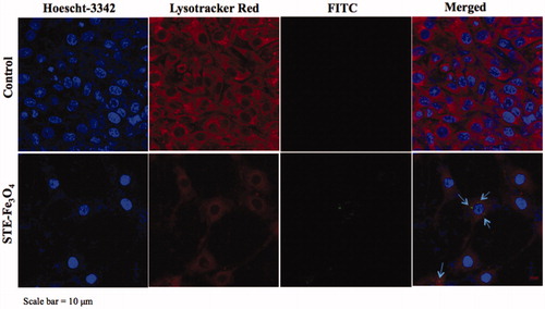 Figure 7. Confocal microscopy of C6 glioma cells to determine sub-cellular localization of nanoparticles in C6 cells (Scale bar = 10 μm). In the figure, nuclei are stained with Hoescht-3342, lysosomes with Lysotracker Red, and MNPs are represented by FITC channel. Arrows indicate sub-cellular localisation of FITC-conjugated MNPs in cells.