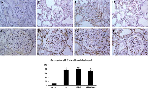 Figure 5.  Representative photographs of immunohistochemistry for PCNA. In rats that received 5/6 nephrectomy, PCNA was expressed slightly higher in nuclei of the glomeruli and renal tubuli than that of the SHAM group rats (B and F). But in rats that received aldosterone infusion, cell proliferation was associated with dramatic increases in the numbers of PCNA-positive (C and G) cells. The numbers of PCNA-positive cells seemed to be much less in aldosterone and DMA–treated rats compared with rats that were treated with aldosterone alone (D and H). A and E: SHAM group; B and F: SNX group; C and G: ALDO group; D and H: ALDO+DMA group. *p < 0.01 versus SHAM group; **p < 0.05 versus SNX group; #p < 0.05 versus ALDO group. Magnification: A–D, ×200; E–H, ×400.