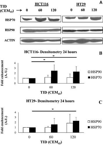 Figure 3. The effect of heat on the regulation of intracellular HSP70 and HSP90. (A) Representative immune-blot images of HSP70, HSP90, and ACTIN in HCT116 and HT29 cells exposed to 0, 60, and 120CEM43 24 h after treatment. (B,C) densitometry data of immunoblot images are shown for HSP70 and HSP90 in HCT116 cells (B) and HT29 cells (C). Data are presented as averages ± Std. dev of at least n = 3 independent experiments. Statistical significance where it exists between cells exposed to a TID of 60 and/or 120CEM43, and cells exposed to a TID of 0CEM43 is denoted with an asterisk ‘⋆‘, and is assumed at p < .05.