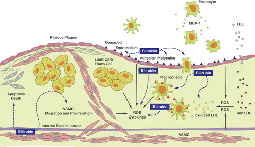 Figure 2. Protective role of bilirubin against atherosclerosis. Oxidation of LDL and ROS itself involves atherosclerosis progression. Bilirubin has antioxidant properties, inhibits monocyte chemotaxis, attenuates expression of adhesion molecules on endothelial cells, improves endothelial dysfunction, and inhibits proliferation of VSMCs. Protective properties of bilirubin in the atherosclerotic processes are indicated as blue dotted arrows. LDL = low-density lipoprotein; MCP-1 = monocyte chemotactic protein-1; ROS = reactive oxygen species; VSMC = vascular smooth muscle cell.