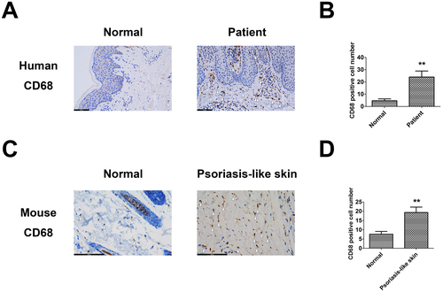 Figure 1. Macrophages accumulated in psoriatic skin. (A, B) CD68+ cells in the skin of normal subjects and psoriasis patients. (C, D) CD68+ cells in normal and IMQ-induced psoriasis-like mice skin. **p < 0.01 versus the normal group.