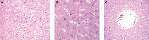 Figure 3.  (A) Effects of C. glaziovii in post injury or prophylactic protocols on CCl4-induced liver damage in rats. Liver tissue sections from rat receiving CCl4. HE × 400, representative of three animals/group. (B) Effects of C. glaziovii in post injury or prophylactic protocols on CCl4-induced liver damage in rats. Liver tissue sections from rat with CCl4 and RCE40 (40 mg/kg) post injury protocol. HE × 400,representative of three animals/group. (C) Effects of C. glaziovii in post injury or prophylactic protocols on CCl4-induced liver damage in rats. Liver tissue sections from rat with CCl4 and RCE (40 mg/kg) prophylactic protocol. HE × 400, representative of three animals/group