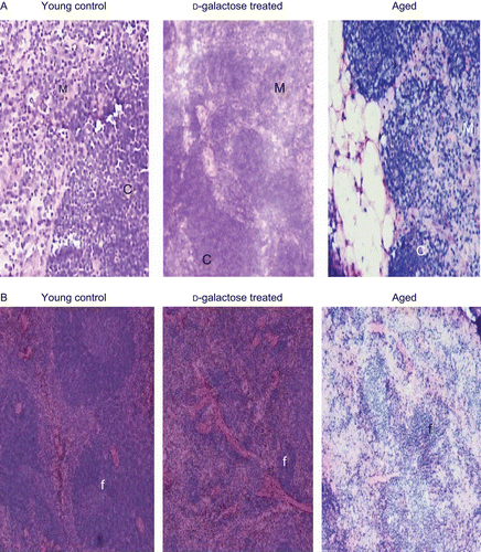 Figure 1.  Morphological changes in thymus and spleen. Frozen sections (5 μm) of (A) thymic and (B) splenic tissues from young mice that had been injected subcutaneously (SC, daily, for 60 days) with 0.4 mL PBS (control) or d-galactose [0.4 mL of solution (in PBS) prepared—based on weekly measures of animal body weight (BW)—to result in a dosage of 50 mg/kg body BW], as well as from aged (24-month-old) untreated C57BL/6J mice. Sections were stained with H&E (hematoxylin and eosin) and then examined under 100× and 200× magnifications for, respectively. the spleen and thymus samples. Images here are from a representative mouse from each regimen (5 mice/group). In the photos of the thymus sections, “M” and “C” indicate medulla and cortex, respectively; in the spleen section photos, “f “indicates a B-lymphocyte follicle.