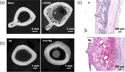 Figure 3. Representative images showing the formation of porosity in the bone near Mg-based alloy implants. (a) Ex vivo micro-CT 2-D images of bone implant complexes after implantation of LAE442 alloy in NZW rabbit tibia for 12 months [Citation21]. T: tibia; F: fibula; E: endosteal bone formation; C: cavities. (b) Micro-CT images of rat femora implanted with pure Mg or SS rod for 2 weeks [Citation20]. (c) Tartrate-resistant acid phosphatase (TRAP)-stained histological slices of mouse femora cortical bone on the 14th days after implantation with Mg or Ti rods.