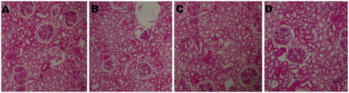 Figure 4. Histopathological picture of kidney of control and treated groups of animals. (A) The section of kidney from control animals revealed normal sizes of glomeruli with normal tubules; (B), (C) and (D) The section of kidney from rats treated with Ferulago carduchorum 250, 500, and 1000 mg/kg body weight showed the normal sizes of glomeruli with normal tubules indicating safety of the extract (20× magnification).