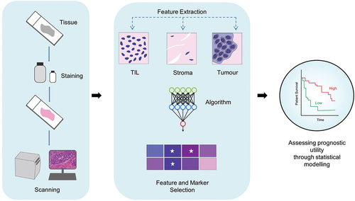 Figure 2. Artificial intelligence (AI) and Digital Pathology Workflow. DIA: data-independent acquisition. Initially, tissue samples are stained to highlight key histological features, followed by the digitization of the samples into high-resolution digital images using scanners. AI-based algorithms are subsequently applied to identify and quantify relevant features (ex-TIL count, stromal, and tumor area) within the images. The final step involves evaluating the association between the identified features and patient survival outcomes through statistical analysis.