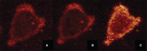 Figure 2. FPE labelled osteoblast imaged using a Leica SP2 Confocal Laser Scanning Microscope. (A) shows a FPE labelled osteoblast – fluorescence can be clearly identified at the cell membrane. (B) shows the same cell, after the addition of 100 µg/ml sodium metasilicate. A decrease in fluorescence is observed. (C) shows the same cell, after the addition of Ca2+ ions (5 mM CaCl2). An increase in fluorescence is clearly visible. This Figure is reproduced in colour in the online version of Molecular Membrane Biology.