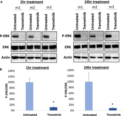 Figure 2. Trametinib downregulates p-ERK in JMML PDX cells. (A) Immunoblotting was performed in cells after 1 h (left, n = 3) and 24 h (right, n = 3) of treatment with trametinib at 200 nM. The control group was untreated cells. A representative blot is depicted. (B) Digital quantification of the bands is shown. Trametinib significantly decreases p-ERK expression relative to total ERK compared to untreated cells (1 h p < 0.001, n = 3; 24 h p = 0.007, n = 3), confirming its mechanism of MEK inhibition. The student’s t-test was used and the error bars depict standard deviation.