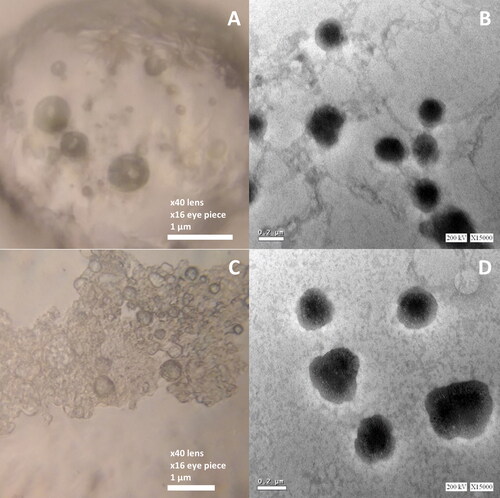 Figure 5. Light (left figures) and TEM (right figures) micrographs of the Opti-Max (A and B) and Opti-Min (C and D) MTC–loaded PEG-T-Chito-Lip nano-vesicular formulations. Abbreviations: MTC, metoclopramide hydrochloride; PEG-T-Chito-Lip nano-vesicular hybrid, PEGylated Tween 80–functionalized chitosan–lipidic nano-vesicular hybrid.