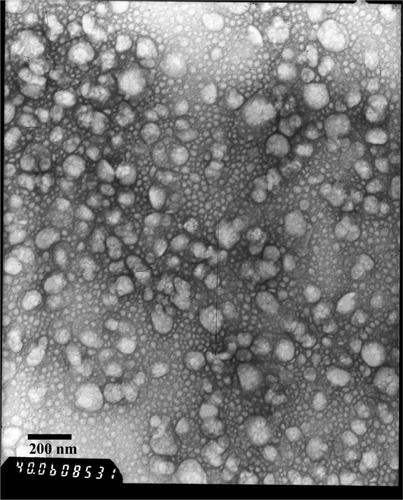 Figure 1.  Transmission electron micrograph of DA-NLCs.