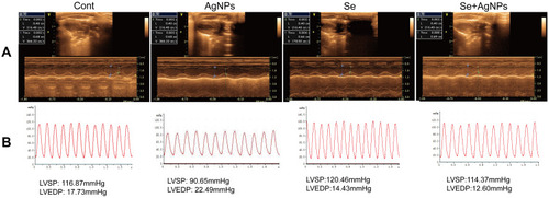 Figure 2 Assessment of cardiac function by echocardiography and invasive hemodynamics. (A) Representative M-mode echocardiograms images were captured in each rat. (B) Representative left ventricular pressure diagrams were recorded in each group.