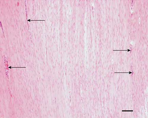 Figure 2. Microscopic longitudinal section (H&E stained) of an injured tendon (C) displaying an organized fibroblastic region. There is a high cellularity with fibroblastic cells and fibers in longitudinal parallel arrangement. Vessels are present between fibers (arrows). C refers to tendon ID (see Tables 1 and 2). Bar = 200 μm.