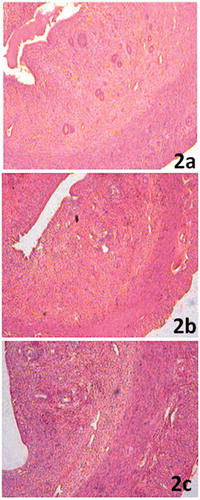 Figure 2. (a) Uterine section from control rats showing normal histological features (100×). (b) Significant thinning of uterine luminal epithelium, myometrium and endometrium with a consequent reduction in the diameter of the uterine horn in arsenic intoxicated rats (100×). (c) Restoration of normal histological features of the uterus in HPD-supplemented group (100×).