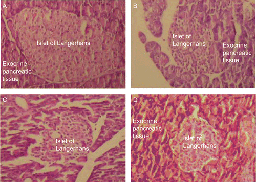 Figure 3.  Light micrographs of rat pancreas under different conditions. A Control rats showing normal pancreatic cells. B Alloxan induced diabetic rats showing change in morphology of pancreatic cells. C Diabetic rats treated with leaf extract from ex situ raised plants showing recovery of injured pancreatic cells D Diabetic rats treated with leaf extract from in situ raised plants showing recovery of injured pancreatic cells.