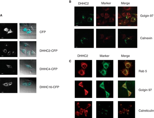 Figure 5. Subcellular localization of DHHC-CFPs and endogenous DHHC2. (A) Confocal microscopy images of HeLa cells transiently expressing the indicated DHHC-CFPs or CFP alone. Scale bars = 10 μm. (B) Confocal microscopy images of HeLa cells transiently expressing DHHC2-CFP with Golgi apparatus indicated by immunofluorescence using anti-Golgin 97 and ER using anti-calnexin antibodies. Scale bars = 10 μm. (C) Confocal microscopy images of HEK293A cells immunostained for DHHC2, Rab5 as a marker of early endosomes, Golgin 97 as a marker for the Golgi apparatus and calreticulin as a marker for the ER.