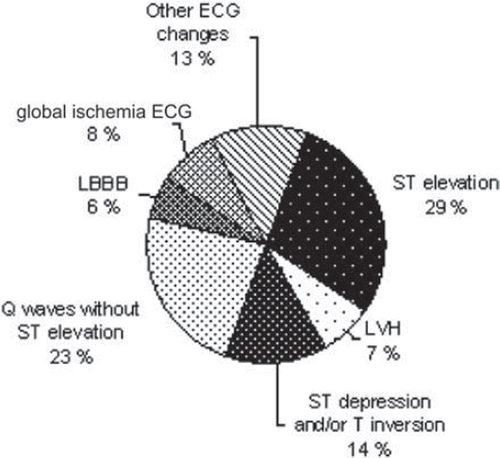 Figure 2. Distribution of ECG changes of all consecutive patients admitted with acute coronary syndrome. Rates are based on the TACOS study, n = 1,188.