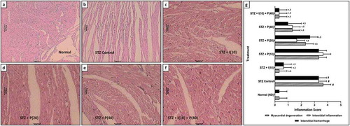 Figure 3. Effect of piperine on STZ-induced alterations in heart histopathology in diabetic rats