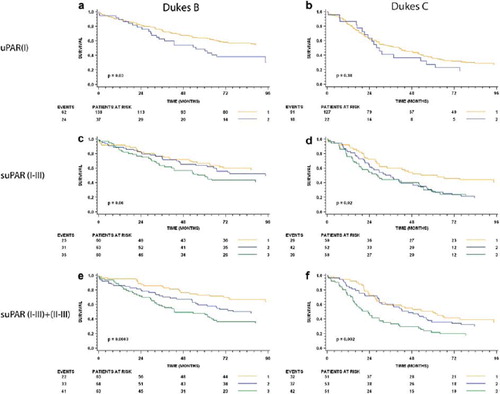 Figure 2. Preoperative serum levels of uPAR(I), suPAR(I–III) and suPAR(I–III)+(II–III) and overall survival for patients with Dukes’ B and Dukes’ C cancer. The upper panel shows the Kaplan-Meier estimates stratified by uPAR(I) (a and b), the middle panel shows the estimates for suPAR(I–III) (c and d) and the lower panel shows the estimates for suPAR(I–III)+(II–III) (e and f). The respective tertiles were used as cut-points. The p-values shown are for the log rank statistic. The number of patients at risk at 0, 24, 48 and 72 months in each strata are shown below each plot with the number of events (deaths) shown to the left.