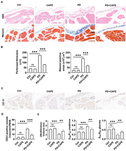 Figure 2. CAPE alleviates PD-induced peritoneal fibrosis. (A) The structural changes of the rat peritoneum in different groups were observed using H&E and Masson’s staining. Magnification, ×400. (B) The bar graphs represent the thickness of the peritoneum and Masson-positive areas. (C) Immunohistochemical staining of CD31 in the rat peritoneum of different groups. Magnification, ×400. (D) The bar graph represents CD31-positive vessels in peritoneum. (E) The results of the peritoneal equilibration test. Data were expressed as the mean ± SD. ns, no significance, **p < 0.01, ***p < 0.001.