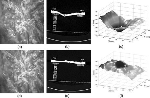 Figure 6. (a and d) Images from the left camera of the stereo rig. (b and e) Two slices from the CT scan at different levels of surface deformation. (c and f) Corresponding 3D plots of the full phantom model surface as reconstructed from the CT data. [Color version available online]