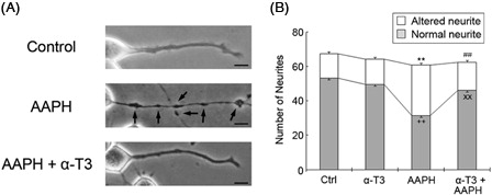 Figure 4. α-Tocotrienol prevents AAPH-induced neurite degeneration. Neuro2a cells were treated with α-tocotrienol (5 µM) in the presence or absence of 1 mM AAPH. After 24 hours, the cells were fixed with 4% PFA in PBS. Photomicrographs of the cells were collected and analyzed on a personal computer. The scale bar represents 10 µm. Arrows indicate bead formation on the degenerating neurites of neuro2a cells (A). The results of quantitative analysis of neurite degeneration are shown (B). Each column represents the mean of three independent experiments. At least three wells were examined per experiment. Data were analyzed using the Student's t-test. ++P < 0.01 between normal control neurites and neurites of neurons treated with 1 mM AAPH. xxP < 0.01 between normal neurites of neurons treated with 5 µM α-tocotrienol in the presence or absence of 1 mM AAPH. **P < 0.01 between altered neurites of control neurons and those of neurons treated with 1 mM AAPH. ##P < 0.01 between altered neurites at 5 µM α-tocotrienol in the presence or absence of 1 mM AAPH.