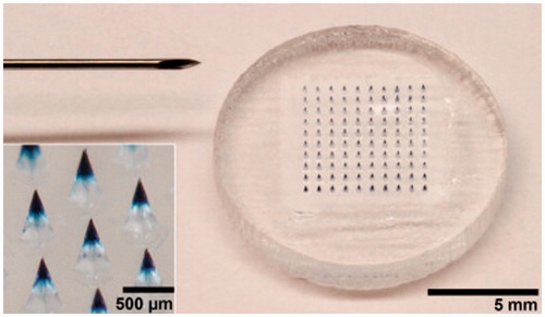 Figure 5. Dissolvable MA for measles vaccination. A microneedle patch is shown next to a 25-gauge hypodermic needle. The patch contains 100 solid microneedles made of water-soluble excipients that encapsulate measles vaccine for delivery to the skin. The inset photo shows a magnified view of the microneedles. To facilitate imaging, the microneedles encapsulated dye (Trypan blue) instead of vaccine. Reprinted with permission from Jacoby et al. (Citation2015).