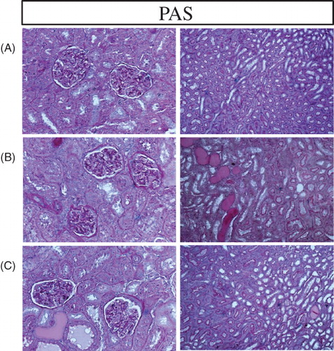 Figure 7. Representative photomicrographs of the PAS-stained renal tissue in a sham-operated control (A) and a 5/6 nephrectomized rat (CKD) treated with vehicle (B) or RTA dh404 (C). The remnant kidney in the CKD animals exhibited significant fibrosis (B) which was reduced with RTA dh404 treatment (C). 20 × magnification.