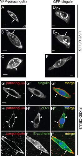 Figure 2. Cingulin and paracingulin show distinct localizations in isolated MDCK cells. (A–F) : Still images (from time-lapse movies) of cells expressing either YFP-CGNL1 (A–C) (A, B from Movie n. 1 ; C from Movie n. 2, see Supplementary Material, available online), or GFP-CGN (D-F) (D, E from Movie n.3, F from Movie n. 4, see Supplementary Material, online). Arrows indicate localization of proteins at the peripheral borders of isolated cells. Square brackets (B, D, E) indicate leading edges of migrating cells. Arrowheads (C, F) indicate cytoplasmic dots. « n » (A, B, D, E, F) indicates the nucleus. « c » (C, D) indicates diffuse cytoplasmic labelling. Asterisks (D, E) indicate cytoplasmic perinuclear labelling. (G–I): Double immunofluorescent labelling of fixed MDCK cells with rabbit anti-paracingulin antibodies (G, H, I), and either mouse monoclonal anti-cingulin (G'), or mouse monoclonal anti ZO-1 (H'), or mouse monoclonal anti E-cadherin (I'). Arrows (G–H) indicate cell periphery labelled by anti-paracingulin but not by either anti-CGN or anti-ZO-1 antibodies. Arrowhead (H) indicates labelling for ZO-1 in a short segment of the cell periphery). Arrow (I) indicates colocalization between accumulated paracingulin and E-cadherin along the cell periphery. Bar = 10 μm.
