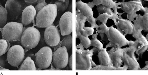 Figure 2 SEM micrographs of the (A) untreated and (B) extract-treated cells of Candida albicans..