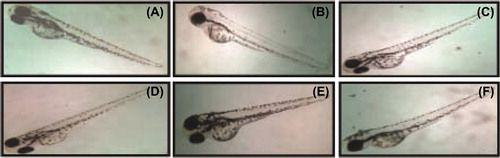 Figure 7. Zebrafish embryos exposed to different concentrations of sodium selenite. (A- control; B-5 μg/ml; C- 10 μg/ml; D-15 μg/ml; E- 20 μg/ml; F- 25 μg/ml).