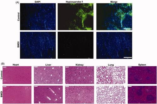 Figure 8. (A) Immunofluorescence images of the tumor slides with hypoxia biomarker staining for control and BMDI-treated groups; (B) Histochemical images of major organs (heart, liver, kidney, lung and spleen) for control and BMDI-treated groups. (Scale bar is 200 µm).