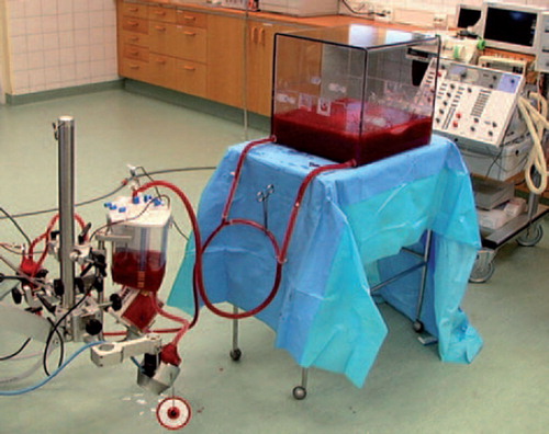 Figure 1. EVLP was performed using the Medtronics Ex Vivo Lung Evaluation Set extracorporeal perfusion circuit by Medtronics (Medtronic AB, Kerkrade, the Netherlands; Ex Vivo Lung Evaluation Set).