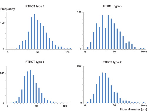 Figure 2. Sample fiber size distribution of type 1 and type 2 myofibers in the supraspinatus muscle of patients with partial-thickness rotator cuff tears (PTRCT, top panels) or full-thickness rotator cuff tears (FTRCT, bottom panels). Note the smaller size (a leftward shift in myofiber histogram) of both myofiber types in the FTRCT patients.