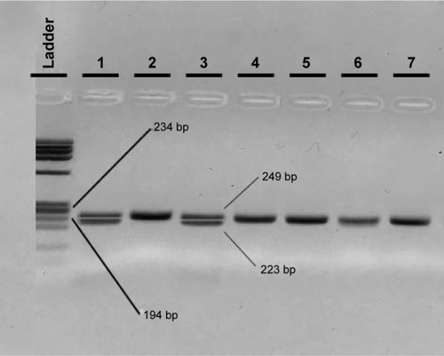 Figure 3 Agarose electrophoresis result of the TLR4 Asp299Gly PCR-RFLP genotyping method.