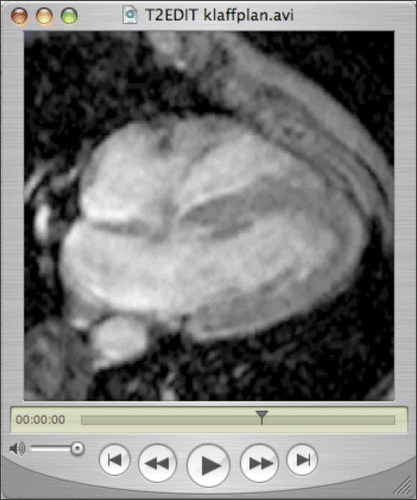 Figure 1. Image-based scenario example. Frame from an MRI movie illustrating the motion of the cardiac chambers.