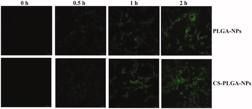Figure 5. Fluorescent images of intracellular uptake of 6-coumarin-PLGA-NPs and 6-coumarin-CS-PLGA-NPs.