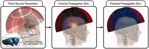 Figure 6. Schematic diagram showing the concept of the ‘virtual source’ correction technique. A point source is placed at the intended target location, here, in the right thalamic ventral intermediate nucleus (VIM). The elements of the phased array transducer are used as receivers, and an ‘inverse propagation’ simulation allows the elements to record the pressure waves as either the entire waveform or the complex pressure phasors. These recorded pressure waves are inverted – either reversed in time for waveforms, or conjugated for complex pressure phasors – and a forward propagation simulation or experiment yields refocusing at the intended target.