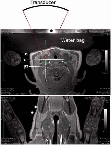 Figure 2. Transverse (top) and coronal (bottom) T1-weighted images of the target region in the pig’s neck. Muscle in the middle section on the right side of the neck was targeted for the treatment. Transverse image also shows the location of the transducer related to the target zone and water bag used for coupling. Locations of the monitoring stacks are also shown where ‘C’ and ‘S’ refer, respectively, to the coronal and sagittal views at focus, and ‘U1’ and ‘U2’ refer, respectively, to the user-defined stacks used to monitor pre-focal and post-focal heating.
